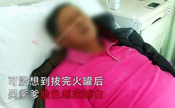 大爺沒事在傢拔火罐，不料竟把右肺給拔沒瞭(2)